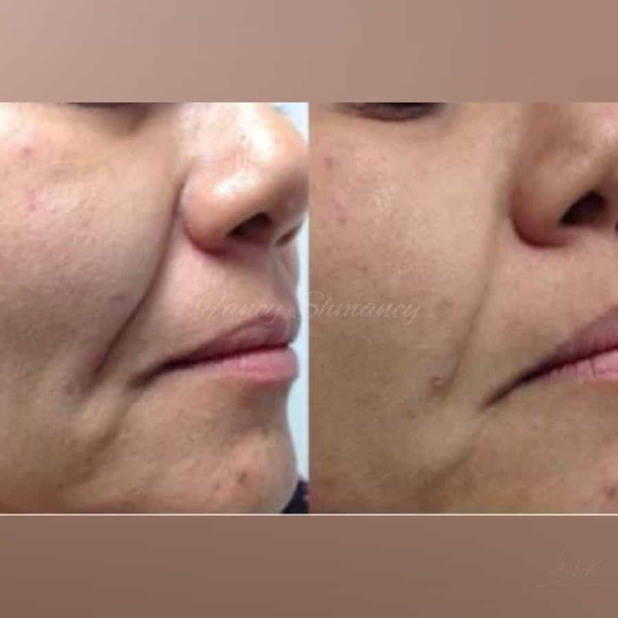 created by InCollage